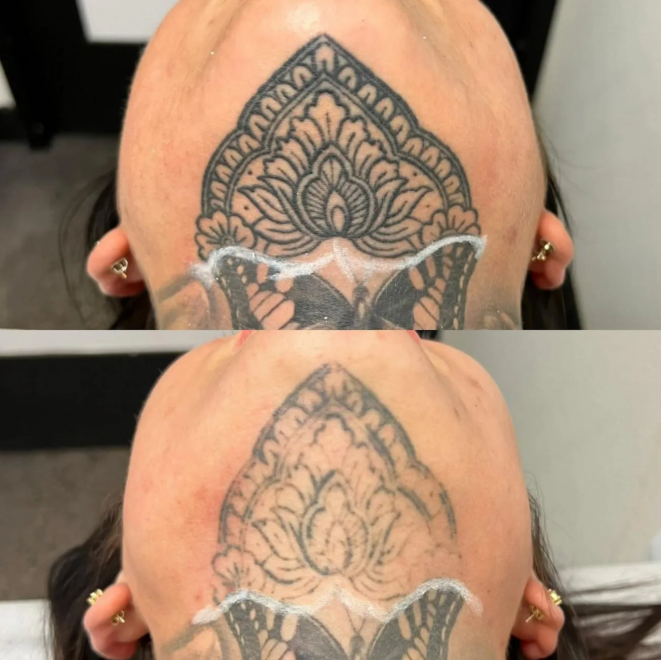 Does It Hurt More Than Getting the Tattoo