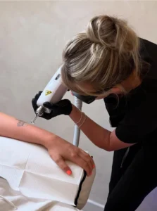 Is it painful to get a tattoo removed